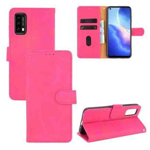 For Blackview A90 Solid Color Skin Feel Magnetic Buckle Horizontal Flip Calf Texture PU Leather Case with Holder & Card Slots & Wallet(Rose Red)