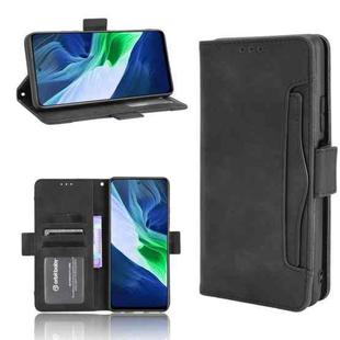 For Infinix Note 10 Pro/Note 10 Pro NFC Skin Feel Calf Pattern Horizontal Flip Leather Case with Holder & Card Slots & Photo Frame(Black)