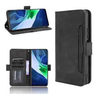 For Infinix Note 10 Skin Feel Calf Pattern Horizontal Flip Leather Case with Holder & Card Slots & Photo Frame(Black)