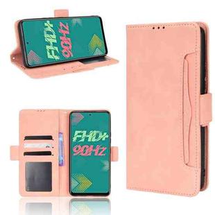 For Infinix Hot 11S Skin Feel Calf Pattern Leather Phone Case(Pink)