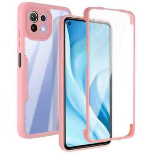 For Xiaomi Mi 11 Lite Acrylic + TPU 360 Degrees Full Coverage Shockproof Phone Case(Pink)