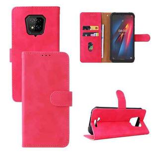 For Ulefone Armor 8 Skin Feel Magnetic Buckle Calf Texture Leather Phone Case(Rose Red)