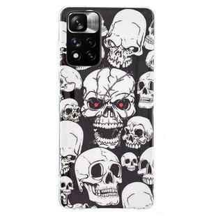 For Xiaomi Redmi Note 11 Pro 4G / 5G Luminous TPU Protective Phone Case(Skull)