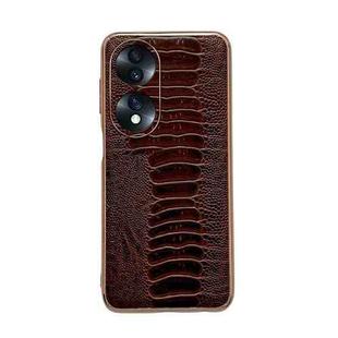 For Hono 70 Genuine Leather Weilai Series Nano Plating Phone Case(Coffee)