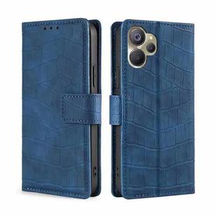 For Realme 9i 5G Global/10 5G Skin Feel Crocodile Magnetic Clasp Leather Phone Case(Blue)