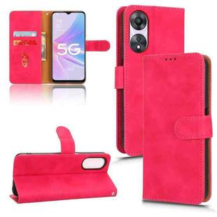 For OPPO A58 5G Skin Feel Magnetic Flip Leather Phone Case(Rose Red)