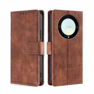 For Honor X9a 5G Skin Feel Crocodile Magnetic Clasp Leather Phone Case(Brown)