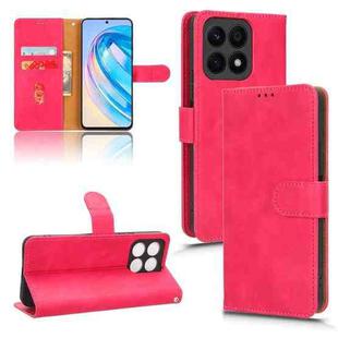 For Honor X8a Skin Feel Magnetic Flip Leather Phone Case(Rose Red)