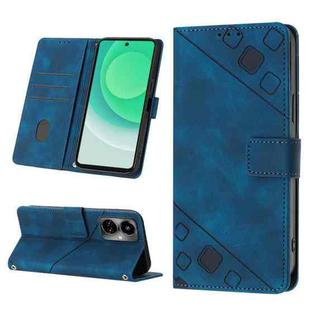 For Tecno Camon 19 Skin-feel Embossed Leather Phone Case(Blue)