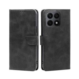 For Honor X8A Calf Texture Buckle Flip Leather Phone Case(Black)