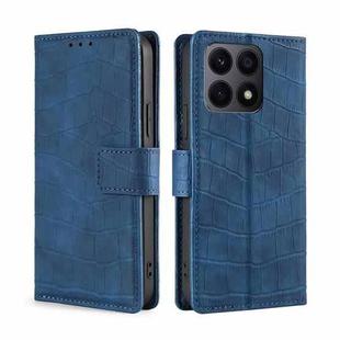 For Honor X8A Skin Feel Crocodile Magnetic Clasp Leather Phone Case(Blue)