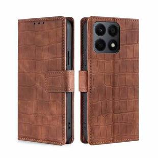 For Honor X8A Skin Feel Crocodile Magnetic Clasp Leather Phone Case(Brown)