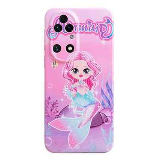 For Huawei P50 Stereo Vision Pattern PC Phone Case(Pink Mermaid)