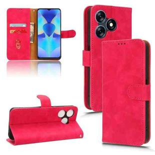 For TECNO Spark 10 Skin Feel Magnetic Flip Leather Phone Case(Rose Red)