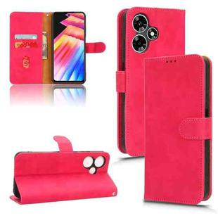For Infinix Hot 30 Play Skin Feel Magnetic Flip Leather Phone Case(Rose Red)