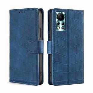 For Infinix Hot 11s NFC Skin Feel Crocodile Magnetic Clasp Leather Phone Case(Blue)