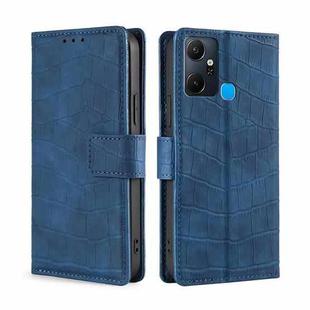 For Infinix Smart 6 Plus Skin Feel Crocodile Magnetic Clasp Leather Phone Case(Blue)