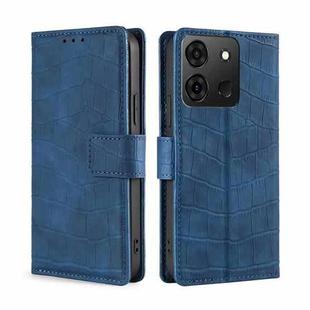 For Infinix Smart 7 Skin Feel Crocodile Magnetic Clasp Leather Phone Case(Blue)