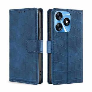 For Tecno Spark 10 4G Skin Feel Crocodile Magnetic Clasp Leather Phone Case(Blue)