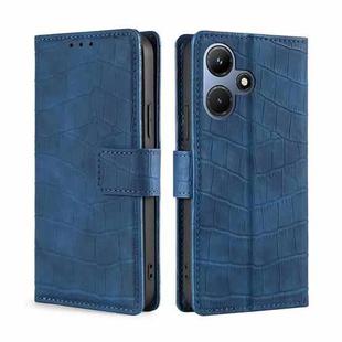 For Infinix Hot 30i 4G Skin Feel Crocodile Magnetic Clasp Leather Phone Case(Blue)
