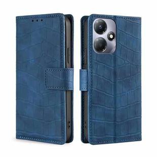 For Infinix Hot 30 Play 4G Skin Feel Crocodile Magnetic Clasp Leather Phone Case(Blue)