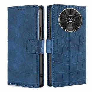 For Xiaomi Redmi A3 4G Skin Feel Crocodile Magnetic Clasp Leather Phone Case(Blue)