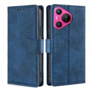 For Huawei Pura 70 5G Skin Feel Crocodile Magnetic Clasp Leather Phone Case(Blue)