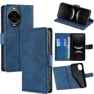 For Huawei nova 14 5G Skin Feel Crocodile Magnetic Clasp Leather Phone Case(Blue)