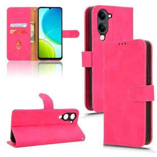 For vivo Y04 4G Skin Feel Magnetic Flip Leather Phone Case(Rose Red)