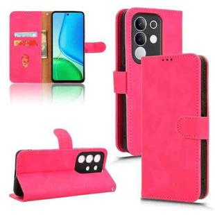 For vivo Y29 4G Global Skin Feel Magnetic Flip Leather Phone Case(Rose Red)