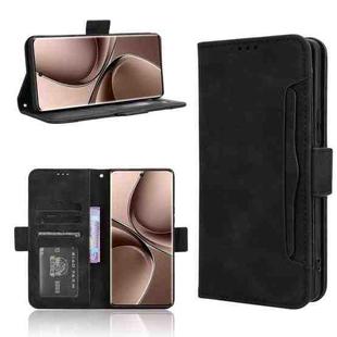 For vivo V40e 5G / iQOO Z9S 5G Skin Feel Calf Texture Card Slots Leather Phone Case(Black)