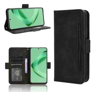 For Huawei nova 11 SE Skin Feel Calf Texture Card Slots Leather Phone Case(Black)