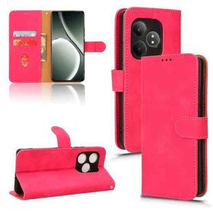 For Realme GT Neo6 SE Skin Feel Magnetic Flip Leather Phone Case(Rose Red)