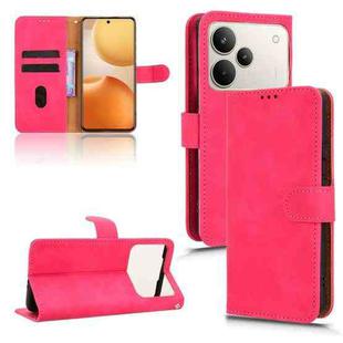 For Realme P4 Pro 5G Skin Feel Magnetic Flip Leather Phone Case(Rose Red)