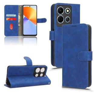 For Infinix Note 30 4G Skin Feel Magnetic Flip Leather Phone Case(Blue)
