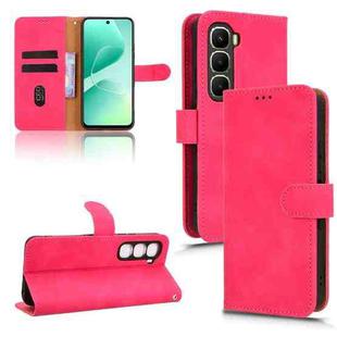 For Infinix Hot 60 5G Skin Feel Magnetic Flip Leather Phone Case(Rose Red)