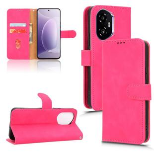 For Honor 300 Skin Feel Magnetic Flip Leather Phone Case(Rose Red)