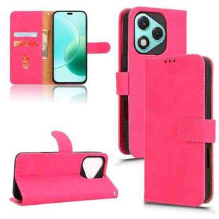 For Honor 400 Lite Skin Feel Magnetic Flip Leather Phone Case(Rose Red)