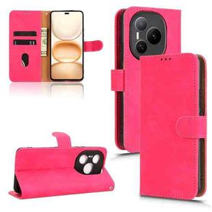 For Honor Power 5G Skin Feel Magnetic Flip Leather Phone Case(Rose Red)