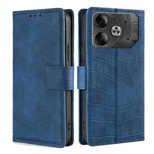 For Tecno Pova 6 5G Skin Feel Crocodile Magnetic Clasp Leather Phone Case(Blue)