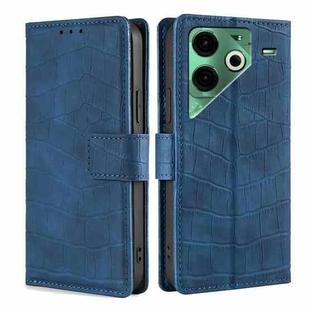 For Tecno Pova 6 Neo 4G Skin Feel Crocodile Magnetic Clasp Leather Phone Case(Blue)