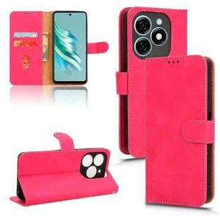 For Tecno Spark 20 Skin Feel Magnetic Flip Leather Phone Case(Rose Red)