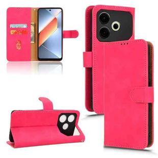 For Tecno Pova 6 Neo Skin Feel Magnetic Flip Leather Phone Case(Rose Red)