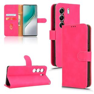For Tecno Camon 40 Skin Feel Magnetic Flip Leather Phone Case(Rose Red)