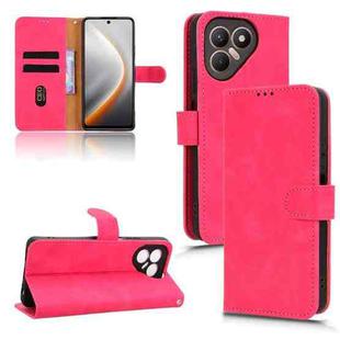 For Tecno Pova 7 5G Skin Feel Magnetic Flip Leather Phone Case(Rose Red)