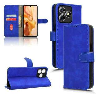 For Ulefone Note 18 Ultra Skin Feel Magnetic Flip Leather Phone Case(Blue)