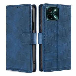 For vivo Y28 4G Skin Feel Crocodile Magnetic Clasp Leather Phone Case(Blue)