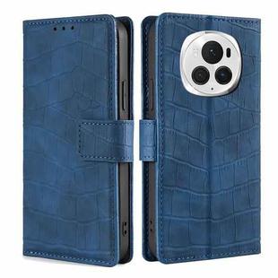 For Honor Magic6 Pro 5G Skin Feel Crocodile Magnetic Clasp Leather Phone Case(Blue)