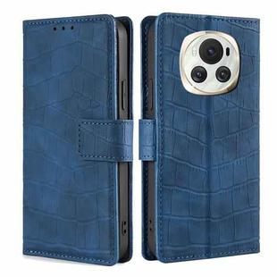 For Honor Magic6 5G Skin Feel Crocodile Magnetic Clasp Leather Phone Case(Blue)