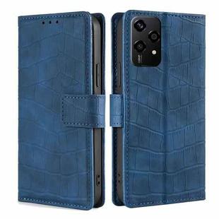 For Honor 200 Lite 5G Global Skin Feel Crocodile Magnetic Clasp Leather Phone Case(Blue)